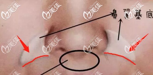 红线就是小胡子的位置 红线就是小胡子的位置