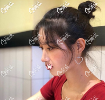 我对这个鼻子特别满意