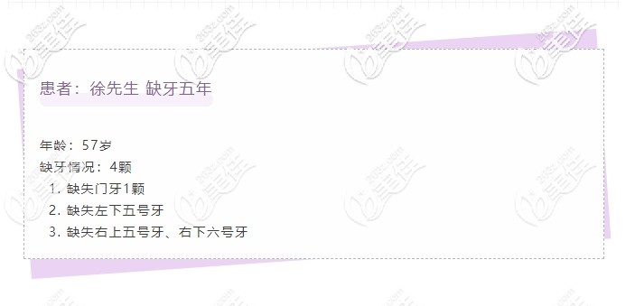 徐叔牙齿缺失病例 徐叔牙齿缺失病例
