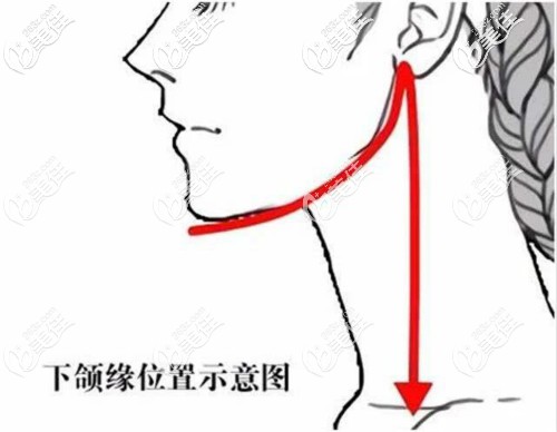 下颌缘位置示意图