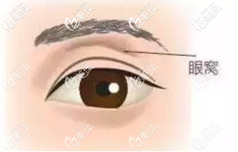 凹陷的眼窝示意图