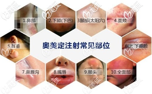 额头异物取出好的医院医生