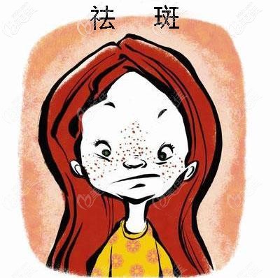 激光祛斑效果怎么样