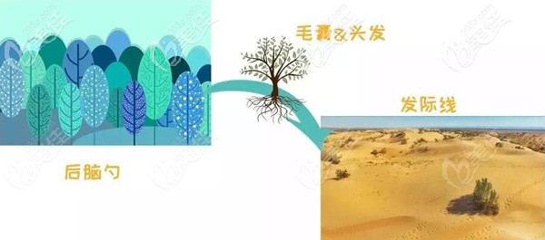 植发手术和植树类似