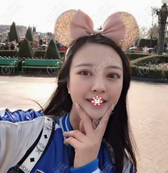 全脸脂肪填充一年后脸凹陷后悔死了你该看看我在重庆光博士的15天恢复照片