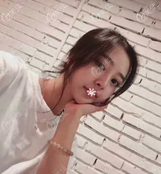 重庆光博士做脂肪填充怎么样 重庆光博士做脂肪填充怎么样