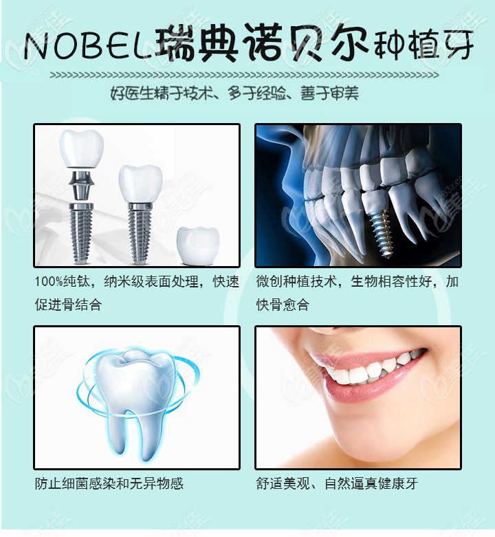 瑞典诺贝尔种植体优势