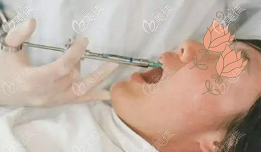 种植牙打麻药示意图