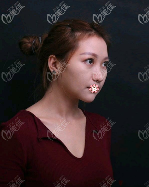 侧面更不好看 侧面更不好看