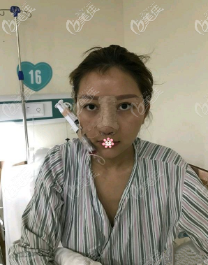 毕胜医生给我手术完第三天 毕胜医生给我手术完第三天