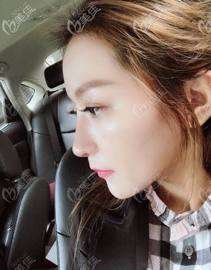 重庆隆鼻好的医生是哪个 重庆隆鼻好的医生是哪个