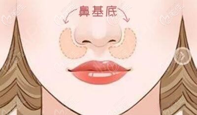 鼻基底位置