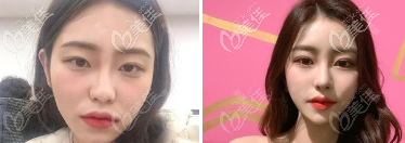 淄博美联臣鼻综合<span style= 淄博美联臣鼻综合<span style=