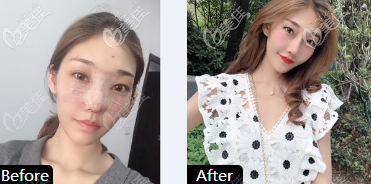 淄博美联臣隆鼻<span style= 淄博美联臣隆鼻<span style=