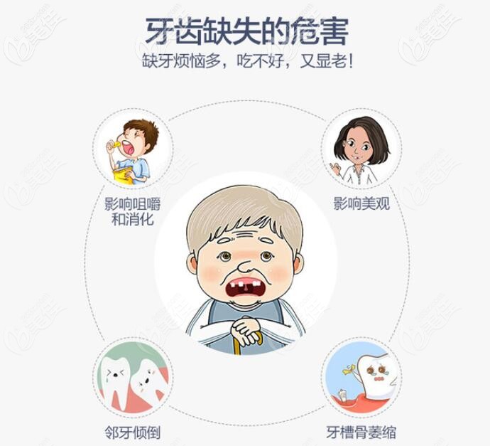 缺牙一定要及时修复 缺牙一定要及时修复