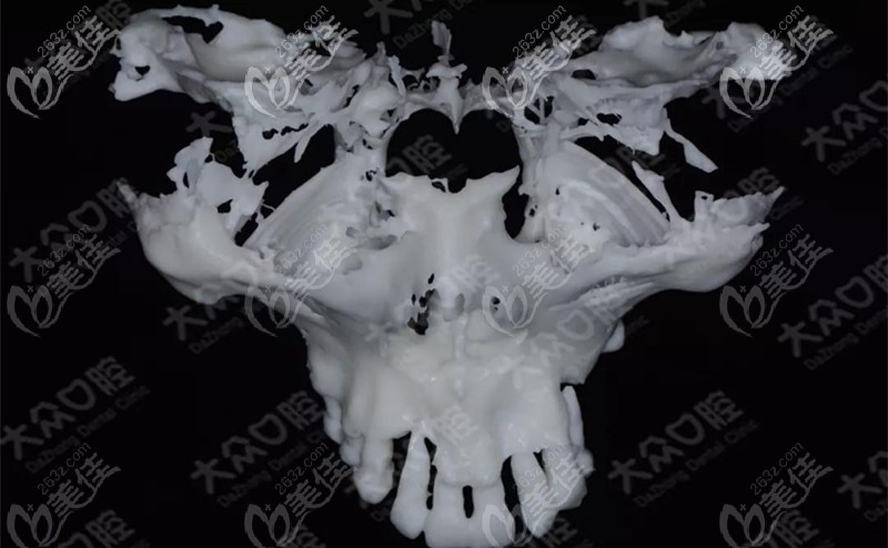 顾客上颌骨的模型 顾客上颌骨的模型