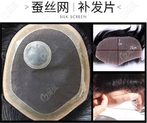 蚕丝网补发片示意图 蚕丝网补发片示意图