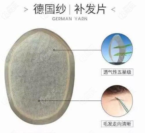 德国纱补发片示意图 德国纱补发片示意图