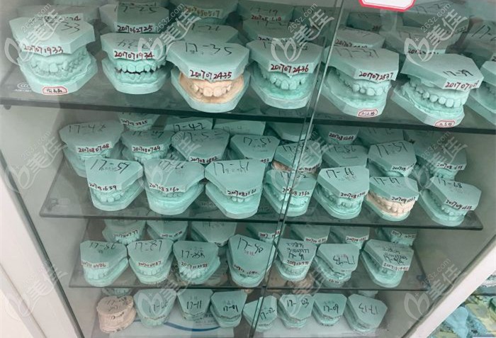 大众口腔某门诊的部分牙模图