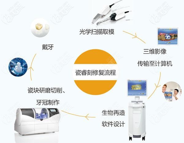 德国瓷睿刻系统的制作流程