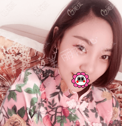 北京画美徐学东耳软骨+硅胶假体综合隆鼻<span style=