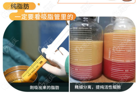 脂肪纯度高 脂肪纯度高