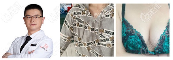 宁波薇琳做隆胸手术实例 宁波薇琳做隆胸手术实例