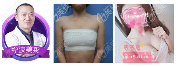 美莱整形做隆胸实例 美莱整形做隆胸实例