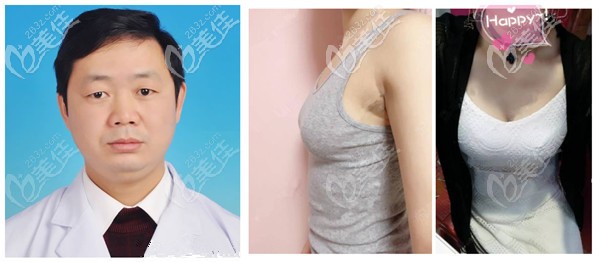 <i data-id='bf5df4e8-bc56-4dd3-9b95-aff3b8c16dff' style='display:none;'></i>医疗美容诊所隆胸实例 <i data-id='bf5df4e8-bc56-4dd3-9b95-aff3b8c16dff' style='display:none;'></i>医疗美容诊所隆胸实例