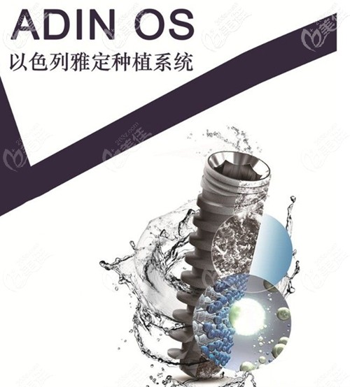 以色列雅定adin种植体