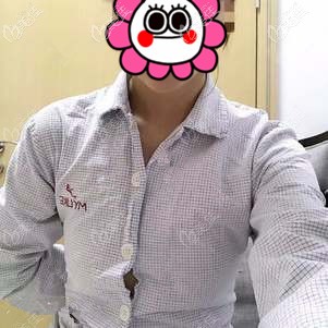 术前胸部平坦 术前胸部平坦