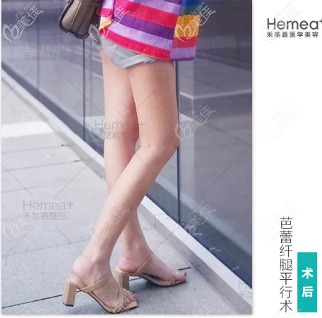 北京禾美嘉任学会腿型矫正<span style=