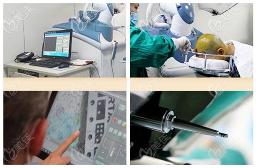 artas机器人植发的操作过程及优势 artas机器人植发的操作过程及优势