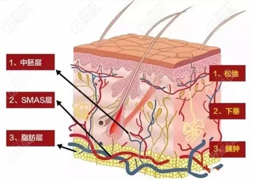 热拉提能达到的层次