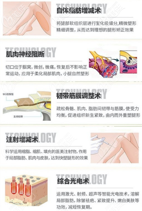 北京京韩整形医院O型腿矫正手术方法