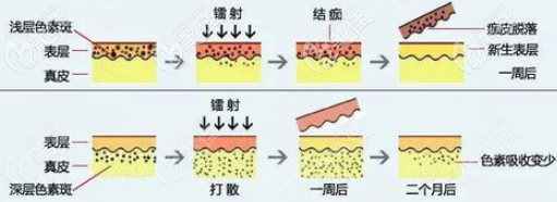 白瓷娃娃美肤过程示意图