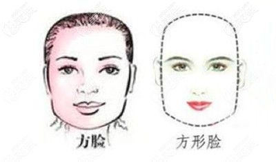 方脸型真的就是要靠磨骨嘛？
