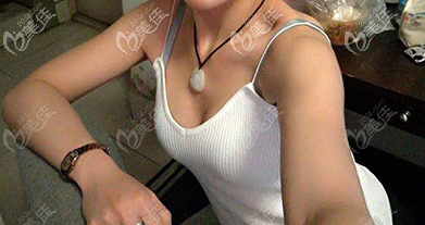济南艺星假体隆胸术前照片 济南艺星假体隆胸术前照片