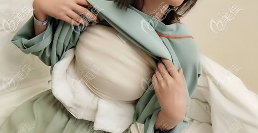 济南艺星假体隆胸术后第五天 济南艺星假体隆胸术后第五天