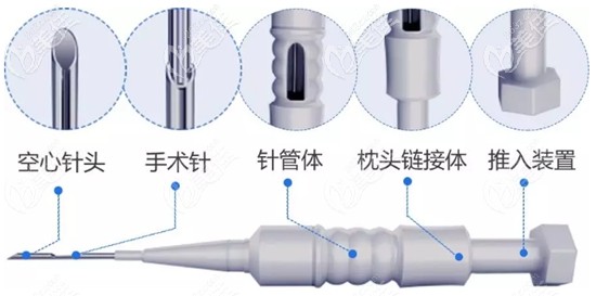 毛发移植中的微针植发技术 毛发移植中的微针植发技术