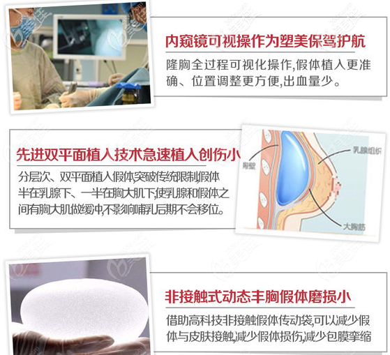 东莞西妃苏顺清隆胸手术优势 东莞西妃苏顺清隆胸手术优势