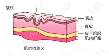 注射生物素除皱 注射生物素除皱