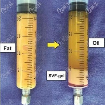 从普通脂肪中提取出的脂肪胶