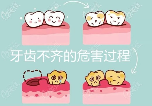 陈明社医生浅谈牙齿矫正的好处