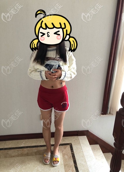 术前腰腹部肥胖