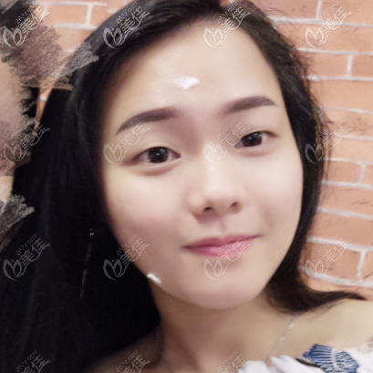 看案例了解广州军美<!--<i data=20240703-sp></i>-->医生技术怎么样 看案例了解广州军美<!--<i data=20240703-sp></i>-->医生技术怎么样