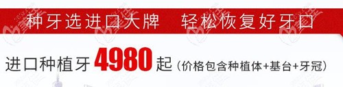 种植牙4980元起 种植牙4980元起