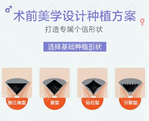 私密种植的种植形状 私密种植的种植形状