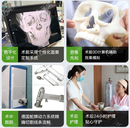 下颌角磨骨手术过程 下颌角磨骨手术过程