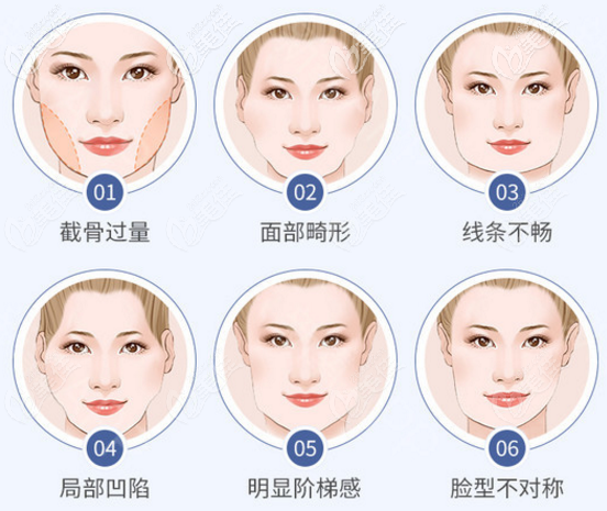 不同类型的颌面修复手术 不同类型的颌面修复手术